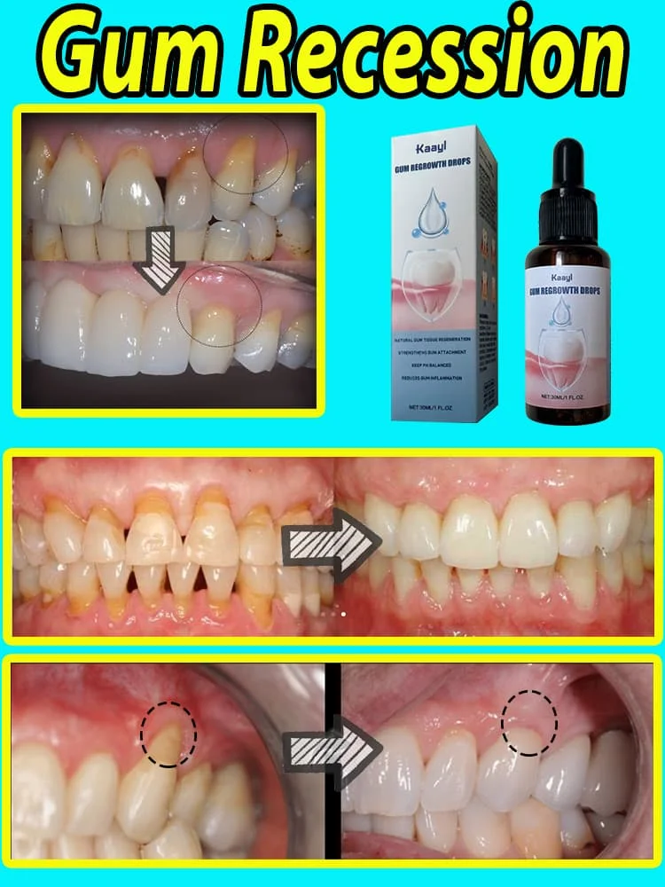 Repair damaged gums relieve gum pain, strengthen gums and restore healthy gums