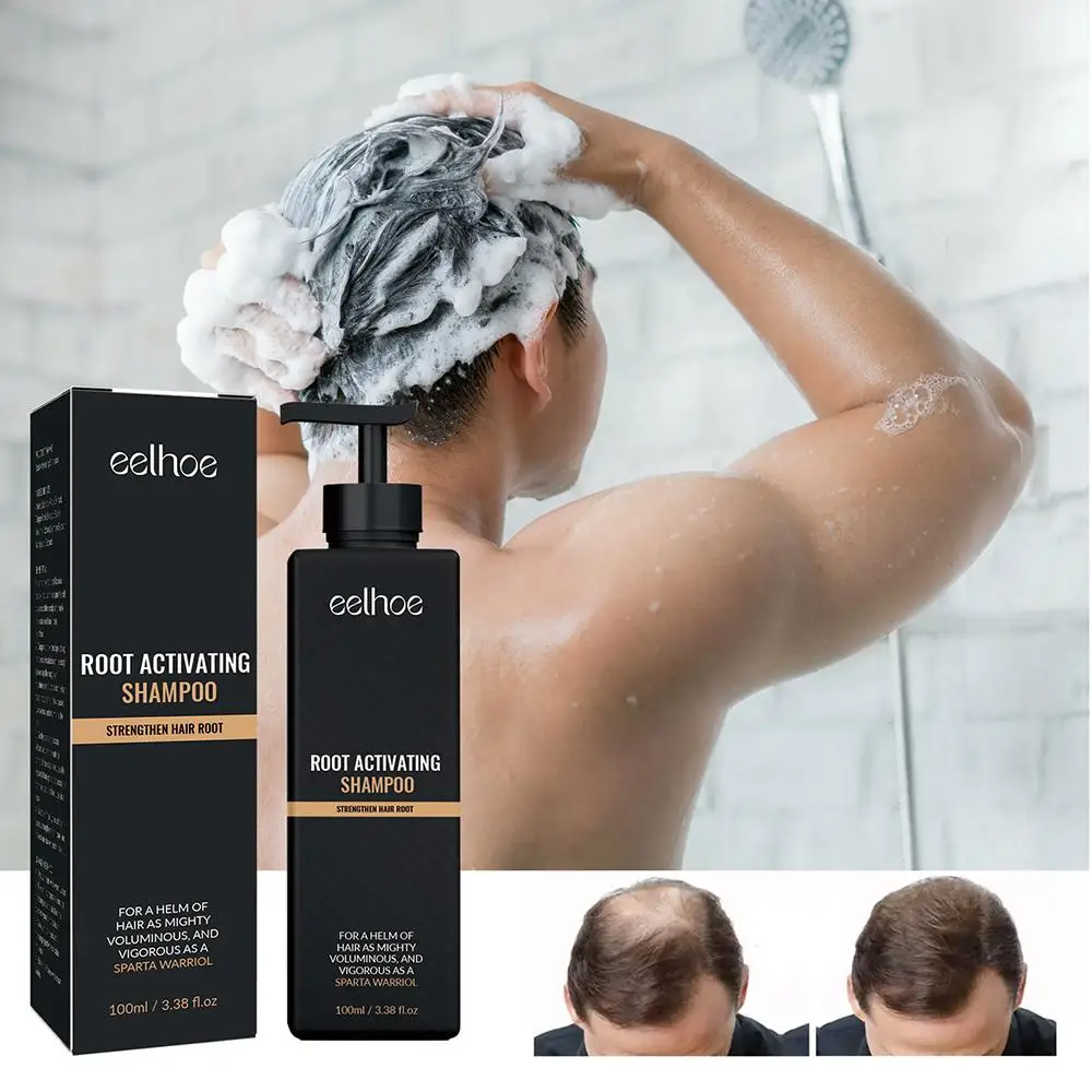 Anti Baldness Shampoo Fast Thicker Dense Deep Cleansing Follicles Strengthen Hairs Root Activating Nourish Hair Regrowth Shampoo