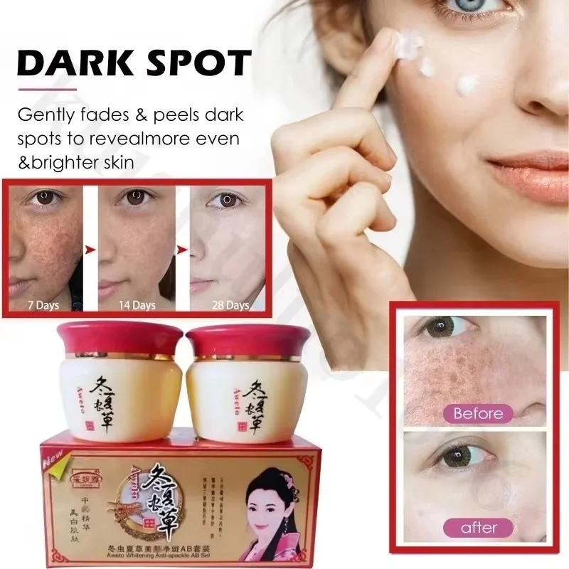 Day Night Cream Best Whitening Freckle Cream Kit Remove Dark Spots Melasma Age Spots Acne Pimples Face Care Cream Set