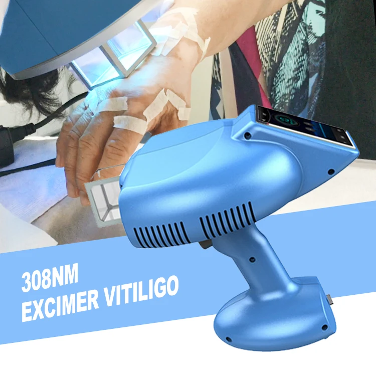 Excimer 308nm Effectively Treatment  Desease Vitiligo Treatment Cure Handheld 308 Nm Lamp