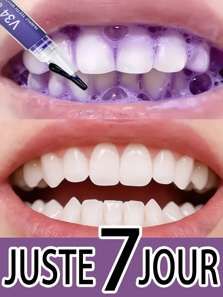 

Отбеливающая паста-карандаш для зубов, удаляющая пятна, без чувствительности — натуральные ингредиенты | Безопасное отбеливание зубов