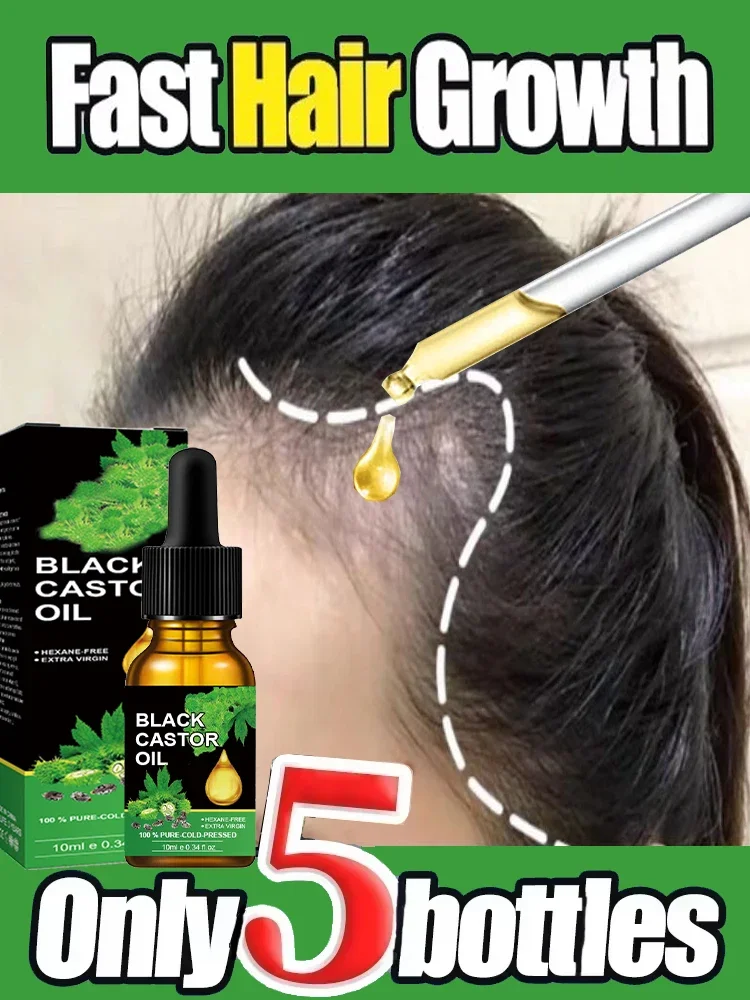 

Fast Hair Growth oil Nurturing hair Reducing hair-loss and breakage Hairs Care Rosemary Essential Oils Anti Hair-Loss