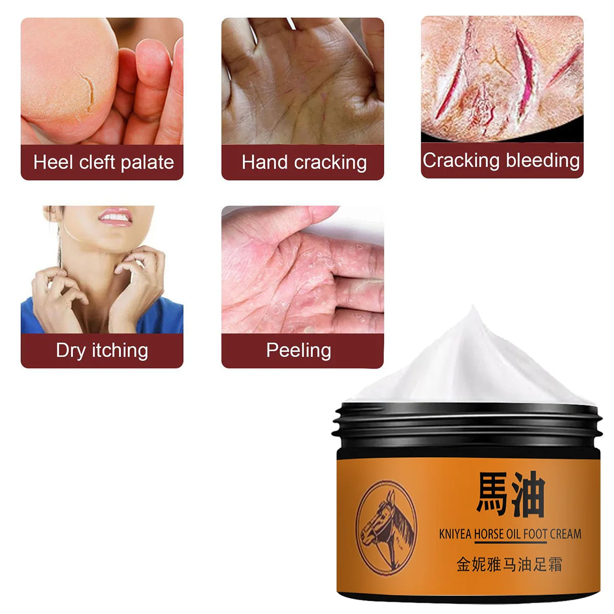 Traditional Chinese Medicine Foot Cream Heel Crack Repair Cream To Remove Dead Skin Hand and Foot Care