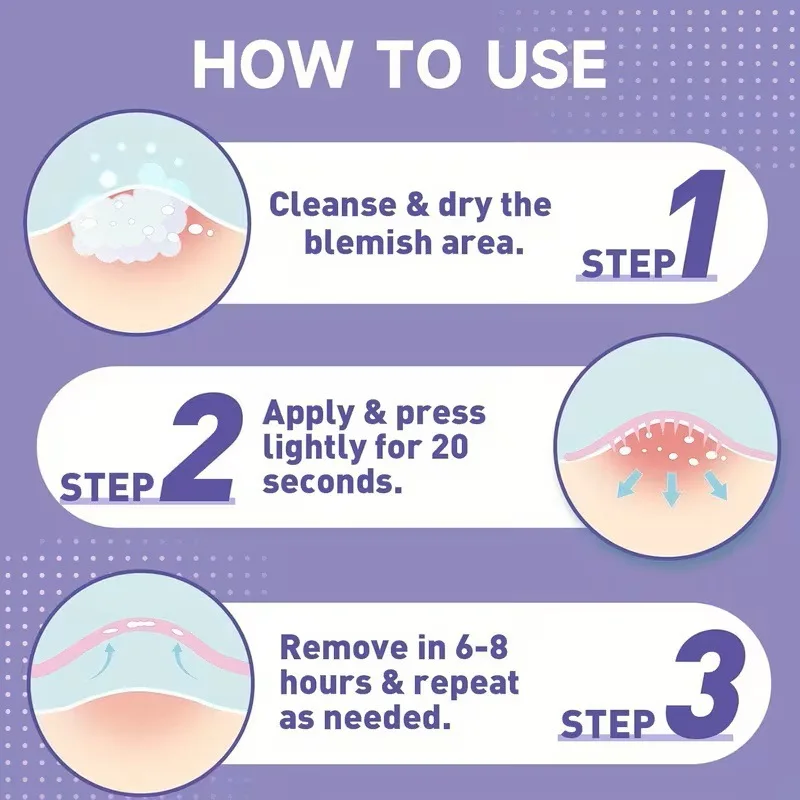 200/400/800pcspcs acne patches, water-based gel non irritating, suitable for all skin types image 5