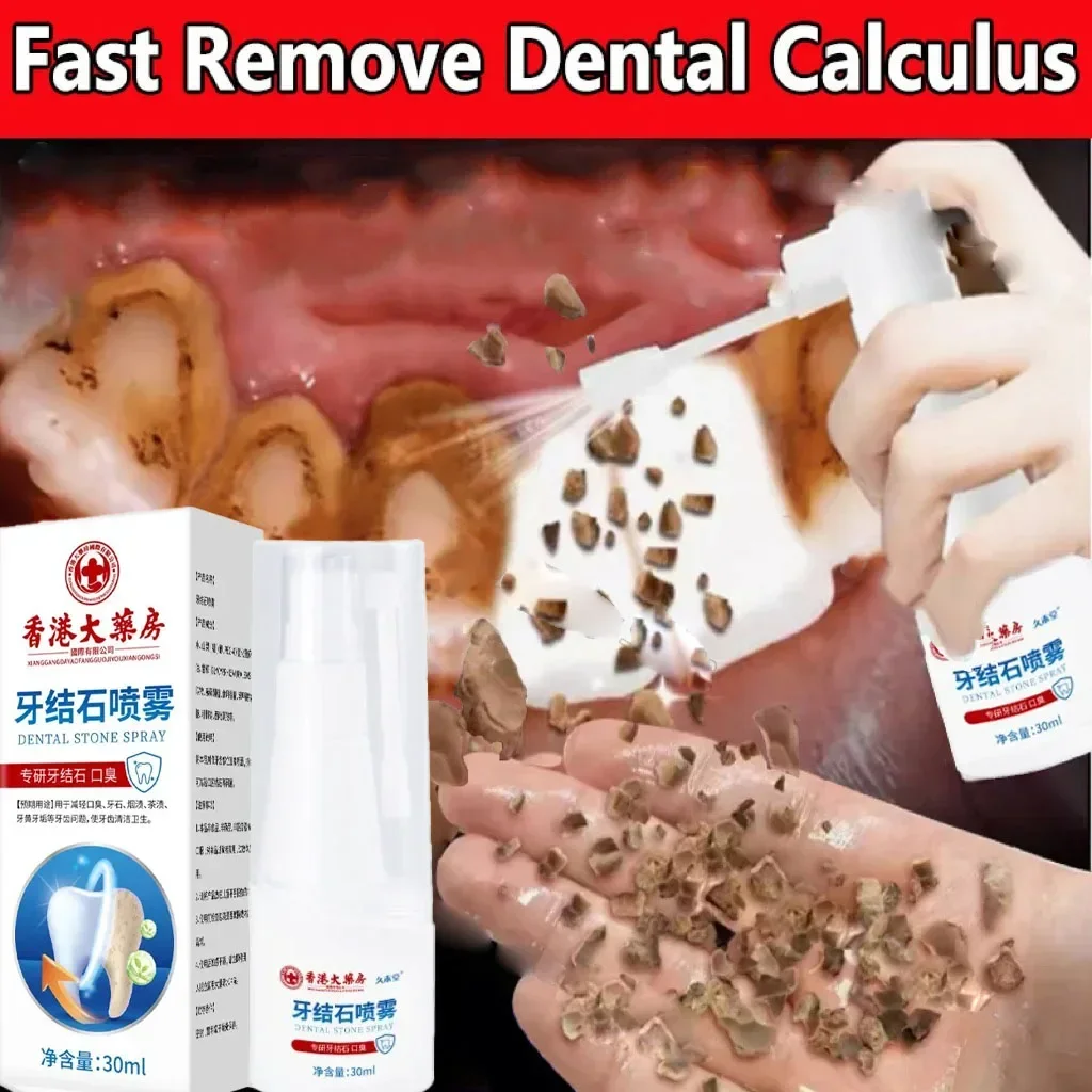 Dental Calculus Remover Teeth Whitening Spray Toothpaste Cleaning Oral Hygiene Removal Halitosis Plaque Stains Fresh Breath Care