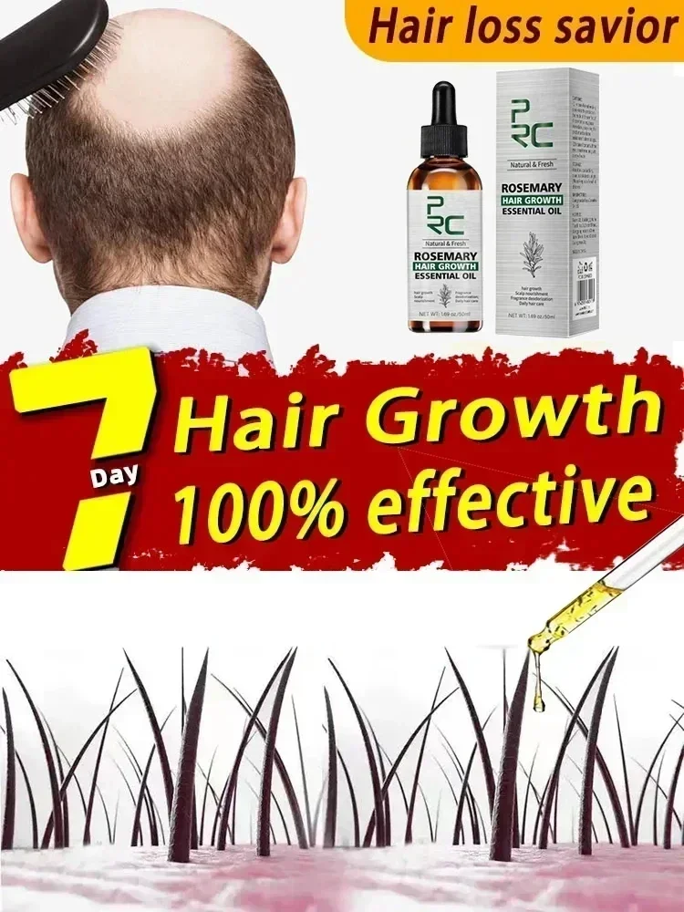 Hair Loss Prevention and Scalp Repair and Nourishing Hair Essential Oil  that strengthens hair and nourishes scalp