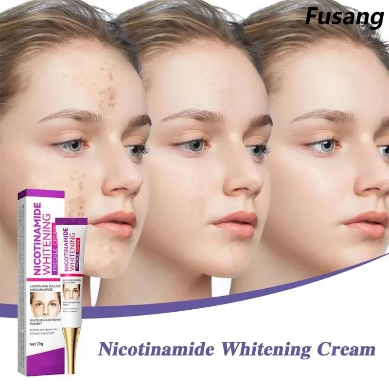 

Nicotinamide Whitening Freckles Cream Powerful Remove Melasma Dark Spot Cream Fade Acne Marks Brightening Skin Face Skin Care