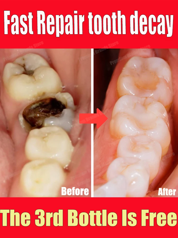 Say goodbye to holes and embrace healthy teeth