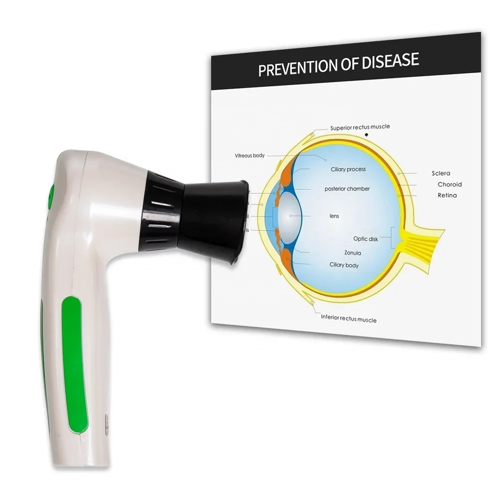 DM-9811U Pathological Analysis Iridology scanner 12M Pixels eye iriscope