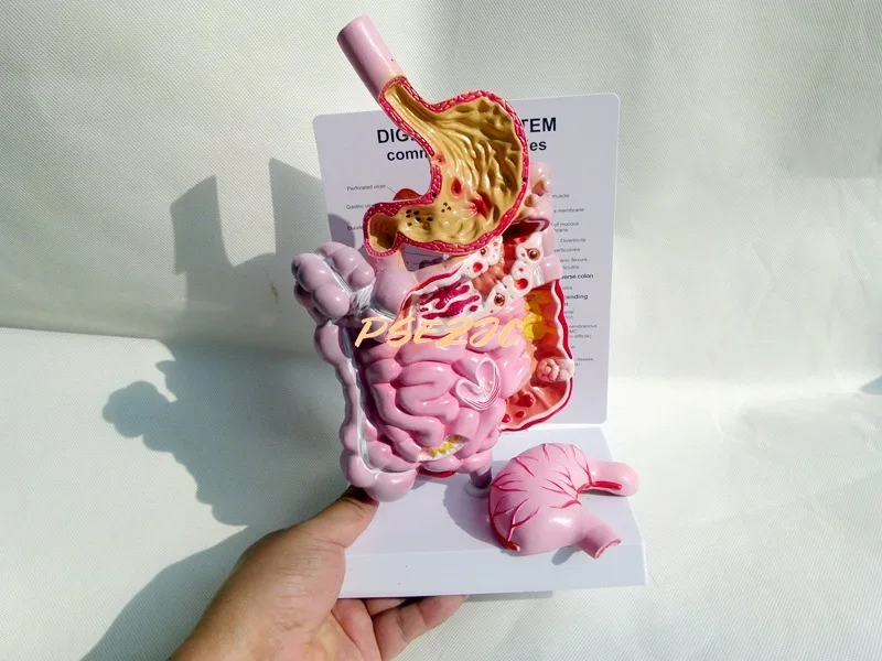 Medical Human Digestive System Large Intestine model Rectum Duodenum Viscera Gastrointestinal Anatomy Model Teaching Supplies