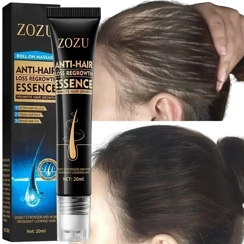 Spray de soro para crescimento capilar para homens e mulheres, tratamento anti-perda de cabelo, reparo de essências, nutre a raiz, rebrota, cuidado capilar