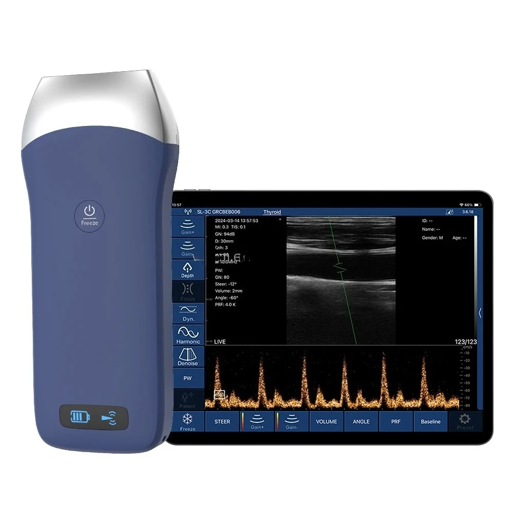 Real-time Imaging Muscle Pathology Diagnoser Dynamic Muscle Contraction Evaluation Medical Detection Equipment