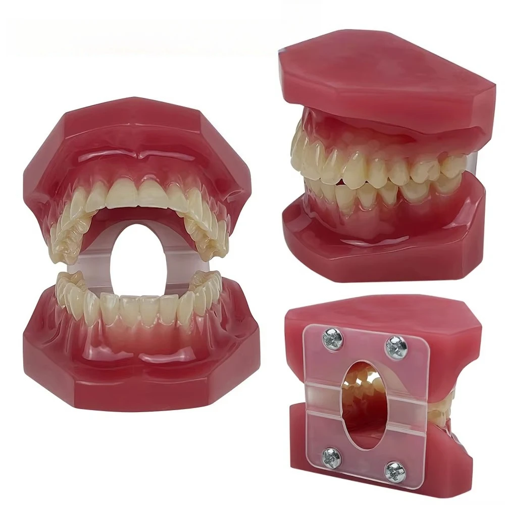 Dental Teaching Model Adult Standard Teeth Model Typodont Jaw Model Dentist Demonstration Tool For Education Training Study