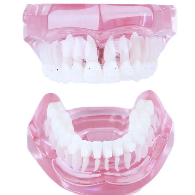 Dental M3002 Orthodontic Teeth Model with Ceramic Bracket