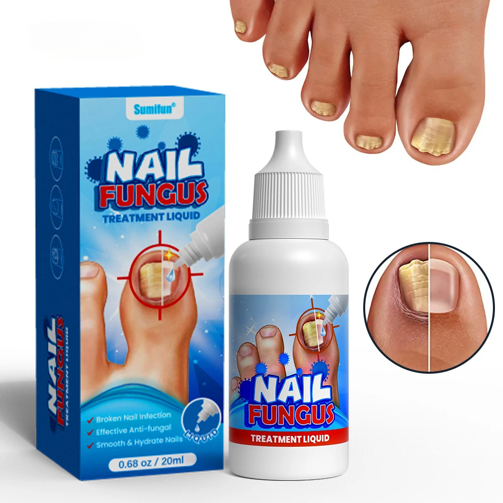 Crema de renovación de Uñas, bálsamo Natural Extra fuerte para Uñas, tratamiento de hongos para Uñas descoloridas