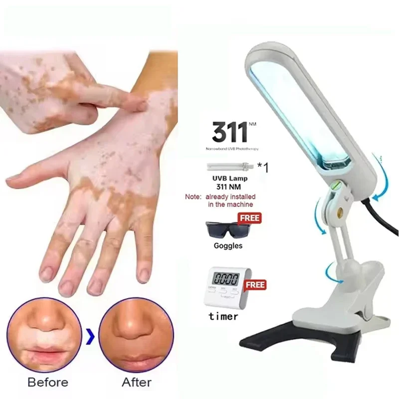 

UVB Phototherapy Narrow 311nm UV Phototherapy Lamp Uvb Light Therapy Vitiligo for Psoriasis Therapy Device
