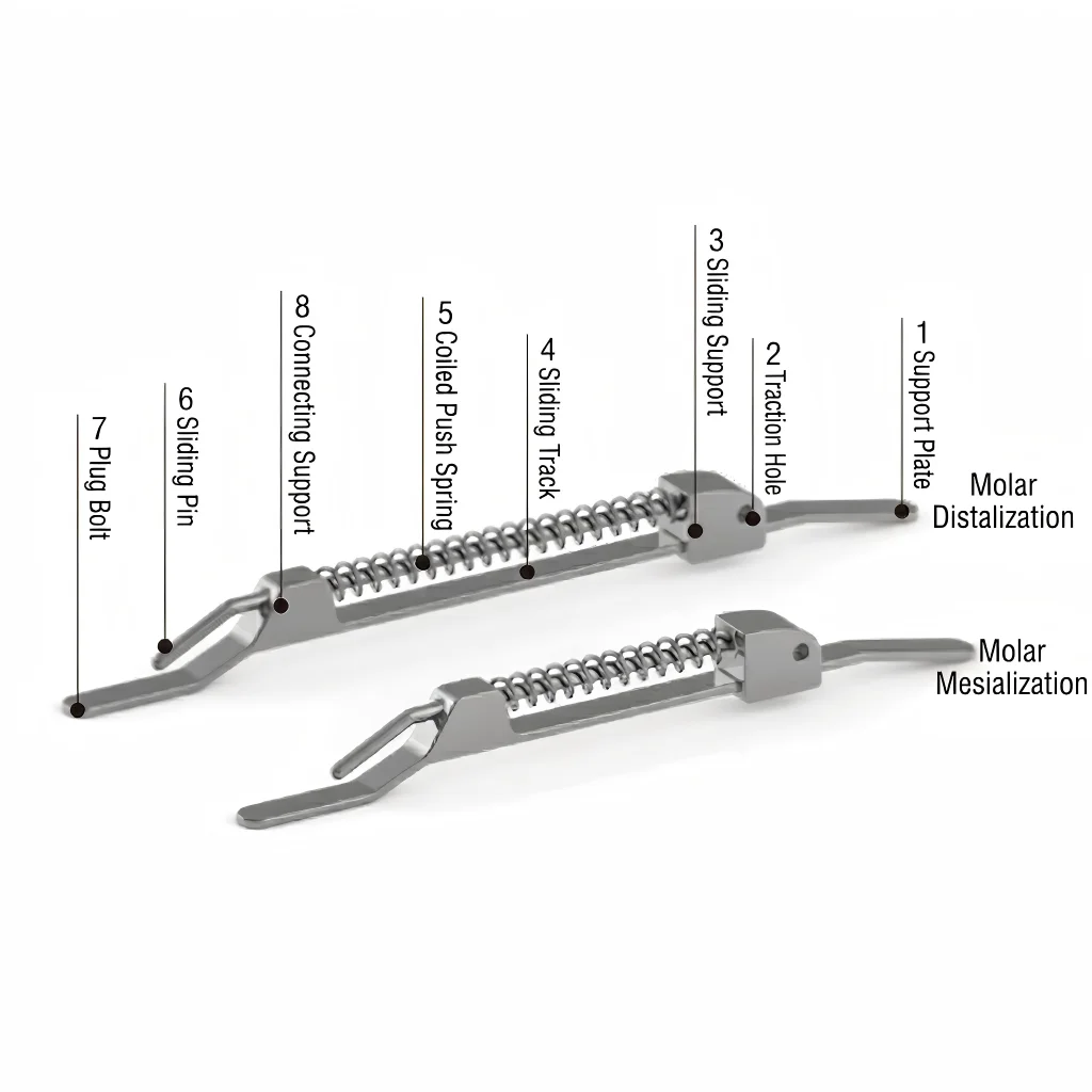 High Precision Orthodontic Molar Push Appliance with Integrated Sliding Tracks and Nickel Titanium Springs Non-Extraction