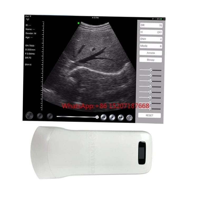 SY-A0C1 Medical Ultrasound Instrument portable black and white wireless ultrasound convex probe