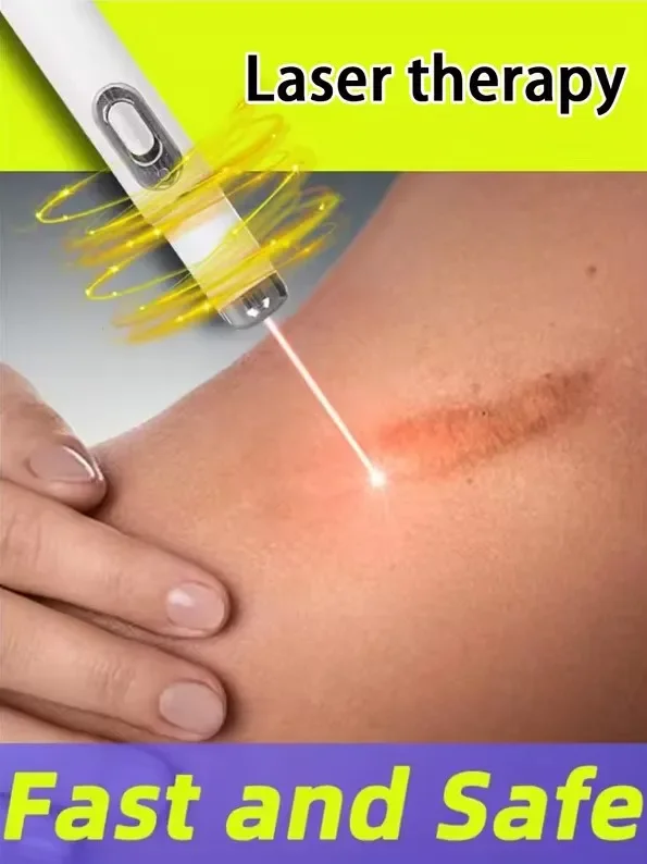 New Laser Therapy Keloid Scar Blue Light Laser Pen White Acne Removal Pen