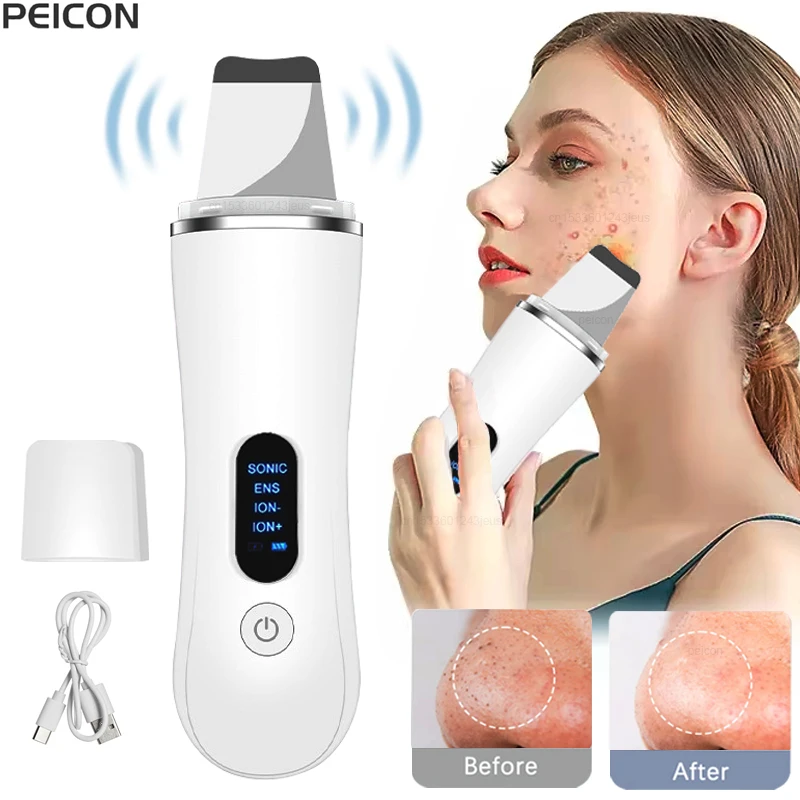 جهاز تنظيف الوجه بالموجات فوق الصوتية آلة تقشير الوجه العميق بالموجات فوق الصوتية جهاز تنظيف البشرة مزيل الرؤوس السوداء حب الشباب المسام تنظيف الوجه الغسيل #1