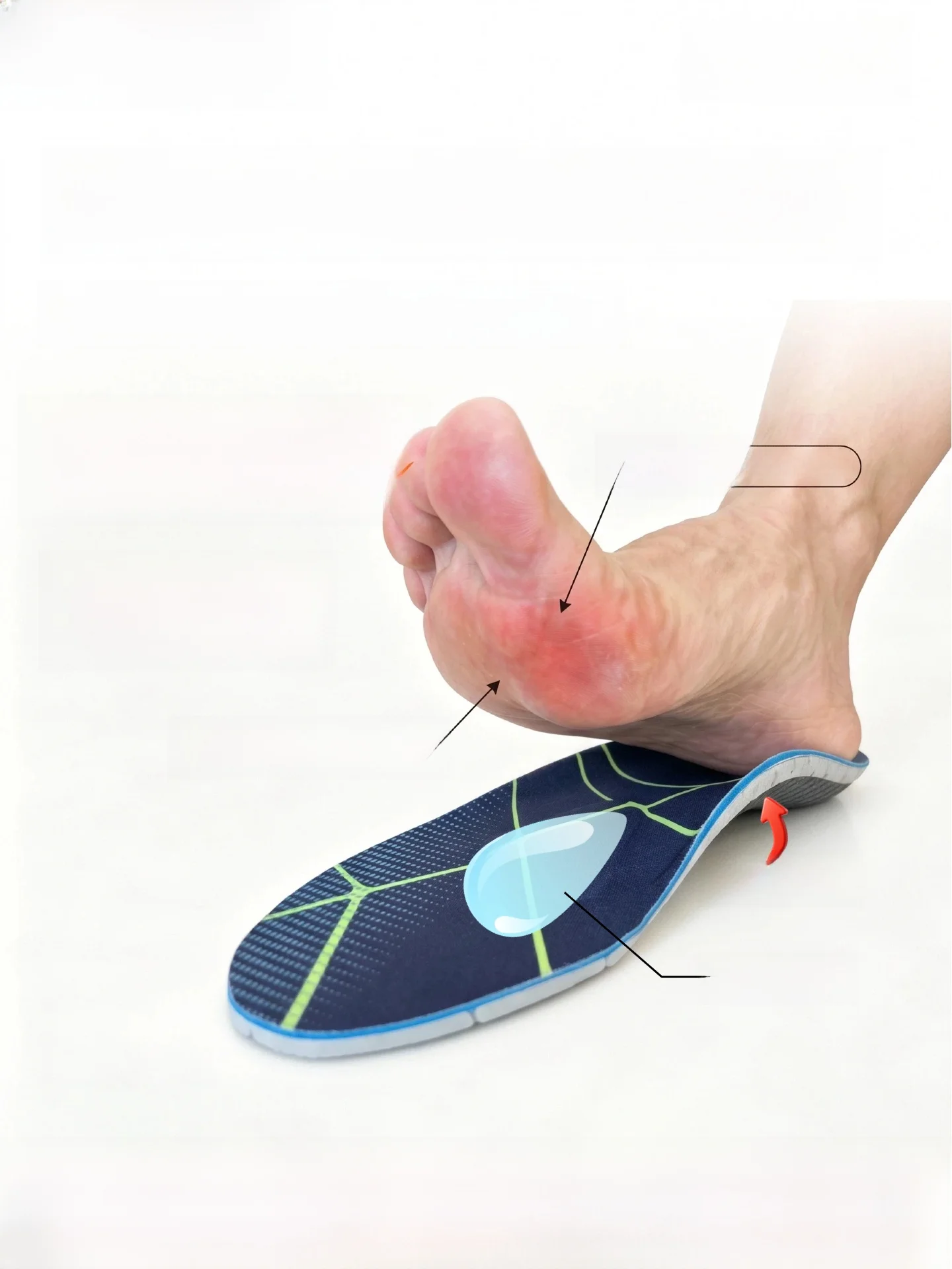 corrective-shoe-insoles-for-bunions-forefoot-pain-callus-plantar-fasciitis-arch-support-professional-footwear-accessories