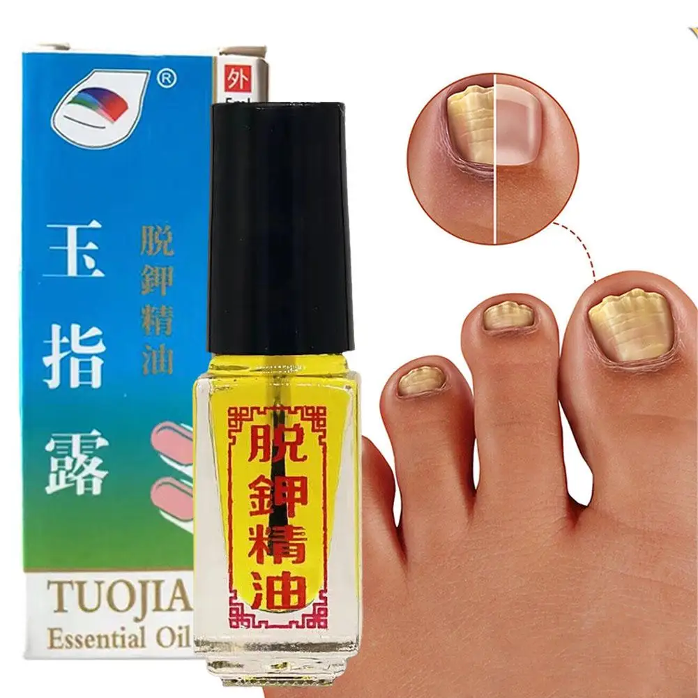 5ml Nail Fungus Treatments Foot Toe Nails Fungal Removal Toe Quick Onychomycosis Effect Gel Hand Oil Anti-Infection Foot Fu K1D7