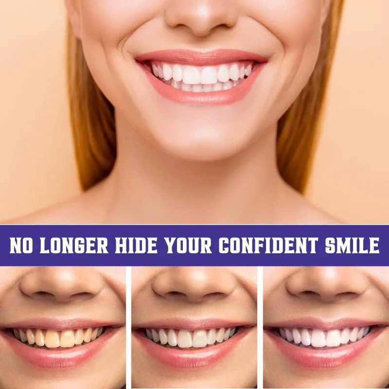 معجون أسنان أرجواني من Smilekit ، مصحح ألوان ، ينظف الأسنان ، تجويف الفم ، يحافظ على الانتعاش ، تقليل البقع الصفراء ، منتج تبييض ، V34