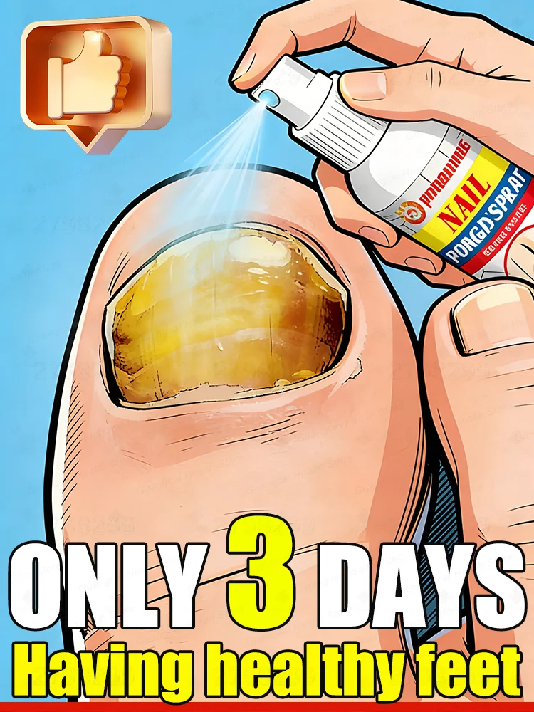 Uᴘɢʀᴀᴅᴇ ɴᴀɪʟ ғᴜɴɢᴜs ᴛʀᴇᴀᴛᴍᴇɴᴛ ᴍᴇᴛʜᴏᴅs ᴛᴏ ʀᴇᴘᴀɪʀ ᴏɴʏᴄʜᴏᴍʏᴄᴏsɪs.Unisex, 2025 model, free shipping. Convenient and effective.