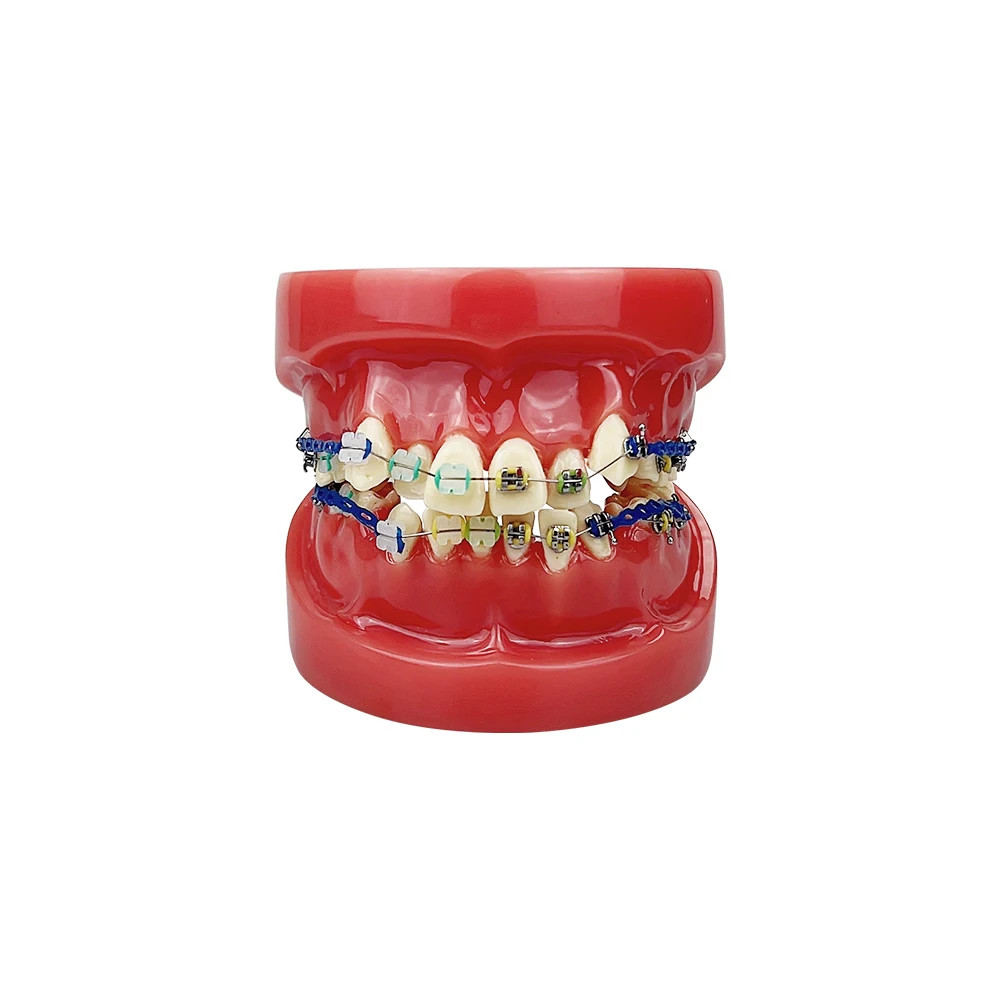 Orthodontic Dental Treatment Teeth Model Teaching Study Gum Tooth Models With Ortho Metal Bracket Arch Wire Ligature Ties Dentis