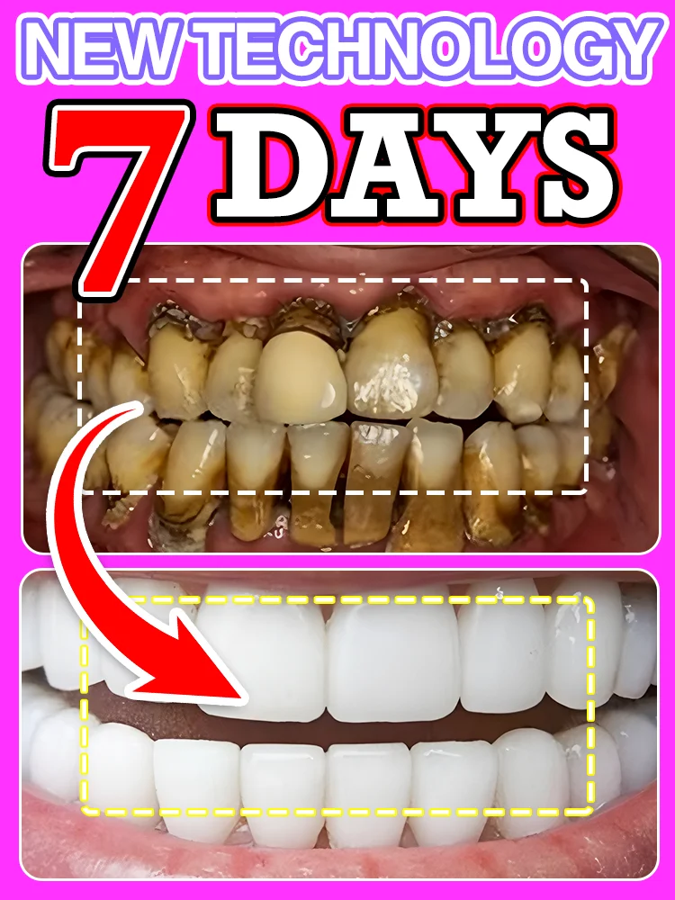 

Brightening smile, eliminating plaque, and effectively enhancing oral hygiene