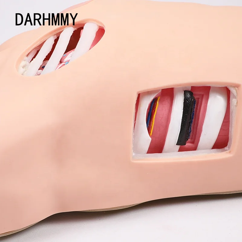 Simulator Drainase Pleura DARHMMY, Model Drainase Temperamentesis, Model Keperawatan Drainase Dada