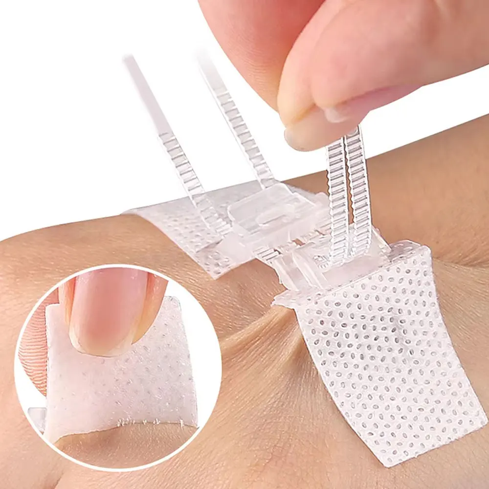 Adhesive Wound Care Zip Sutures Bandage First Aid Without Stitches Emergency Wound Closures Emergency Laceration Repair