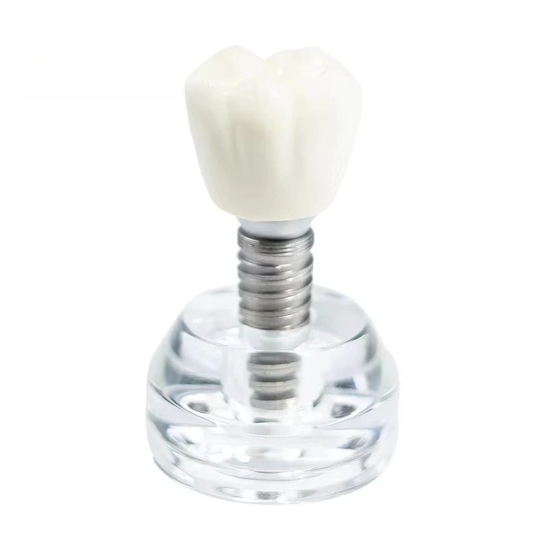 Teaching Model Transparent Crystal Crown Removable Denture Model For Student Learning