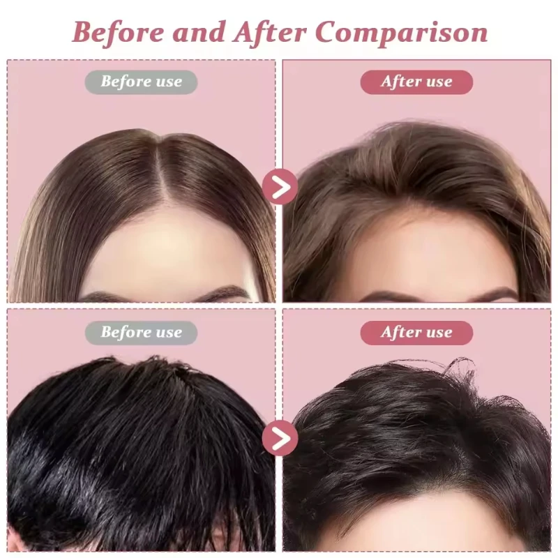 2 Buah Jepit Rambut Halus Klip Poni Keriting Set Klip Rambut Penambah Volume Akar Rambut Klip Tetap Keriting Wanita Rol Rambut Volume Mode