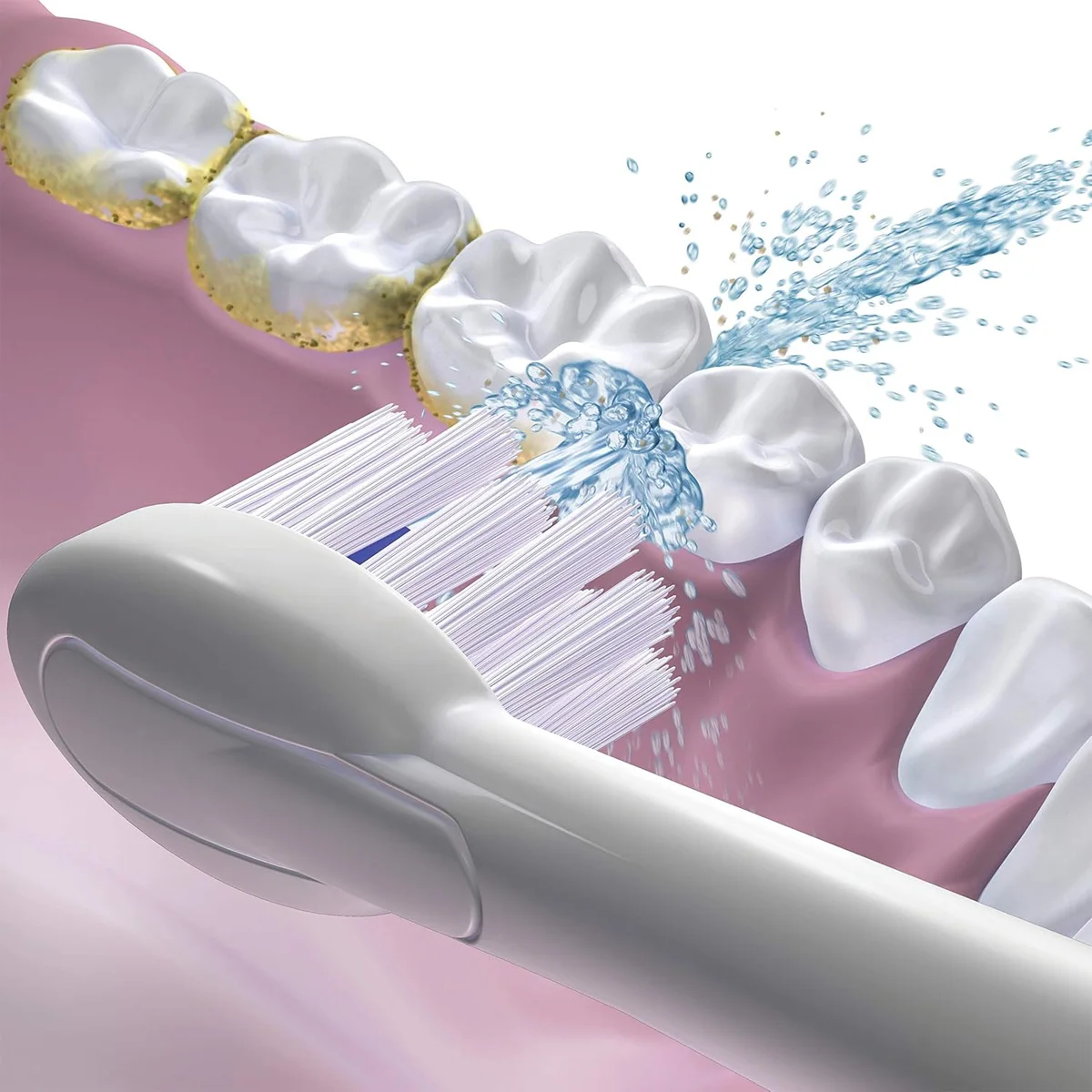 رأس فرشاة لفرشاة أسنان Waterpilk Sonic-fusion 2.0، شعيرات مدمجة وناعمة لفرشاة الأسنان Waterpick الاحترافية