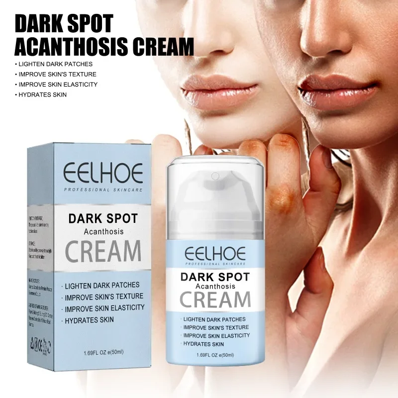 

Sdatter Dark Spot Cream Body Whitening Underarm Bleaching Armpit knee Elbow brightening Neck Lips remove Melanin Improve Dull sk