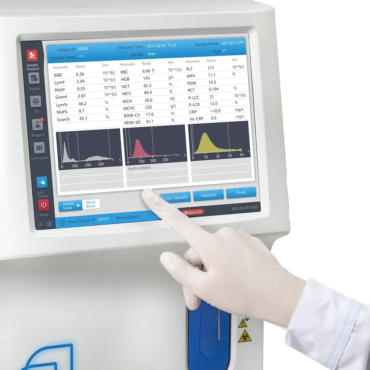 Zybio Z3 analisador de 3 partes totalmente automático analizador de hematologia cbc máquina para laboratório