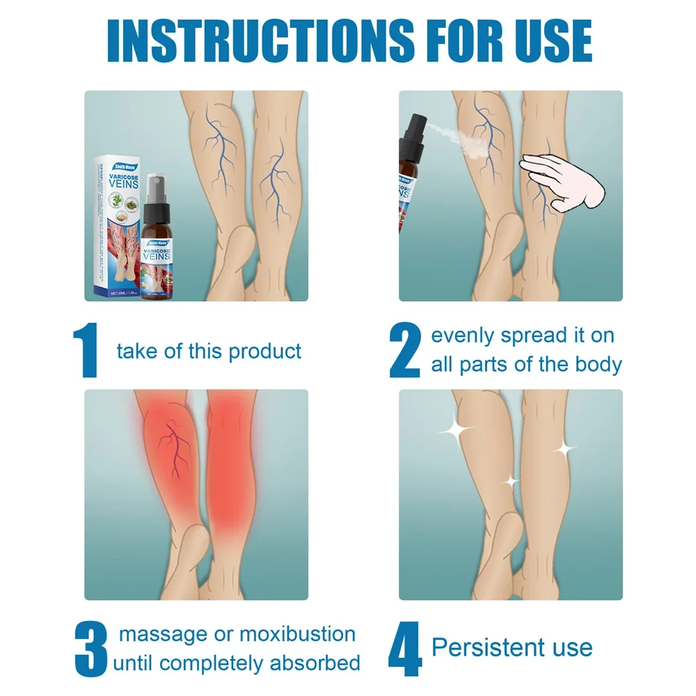 30ml Varicose Vein Spray Vasculitis Phlebitis Spider Legs Smoothing Blood Vessel Bulging Treatment Redness Leg Body Care