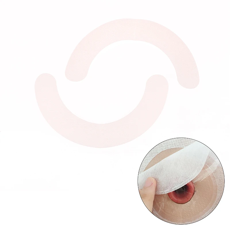 Ostomy Barrier Strips Half Rings Proof Cuttable Hydrocolloid Ostomy Barrier Tape Hypoallergenic for Colostomy Bags