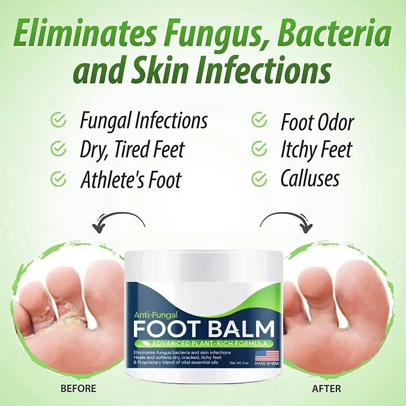 Foot Cure All-Natural Plant Foot Balm – Moisturizing Foot Care Cream for Dry Skin