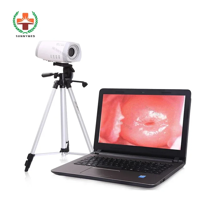 

SY-F003 wholesale price visual inspection of the vagina and cervix medical device Handheld Colposcope