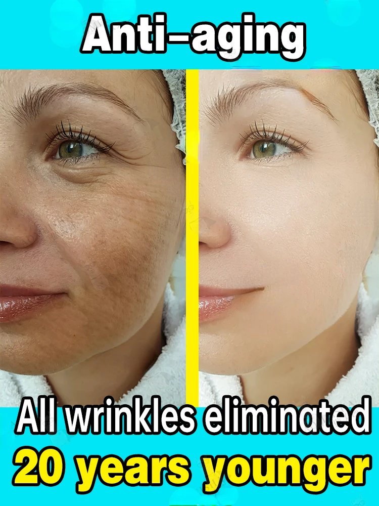 2023 New Upgrade Wrinkle Removal Serum Anti-aging Fade Fine Line Firm Lift Whitening Freckle Sensitive Skin Repair For Women Men