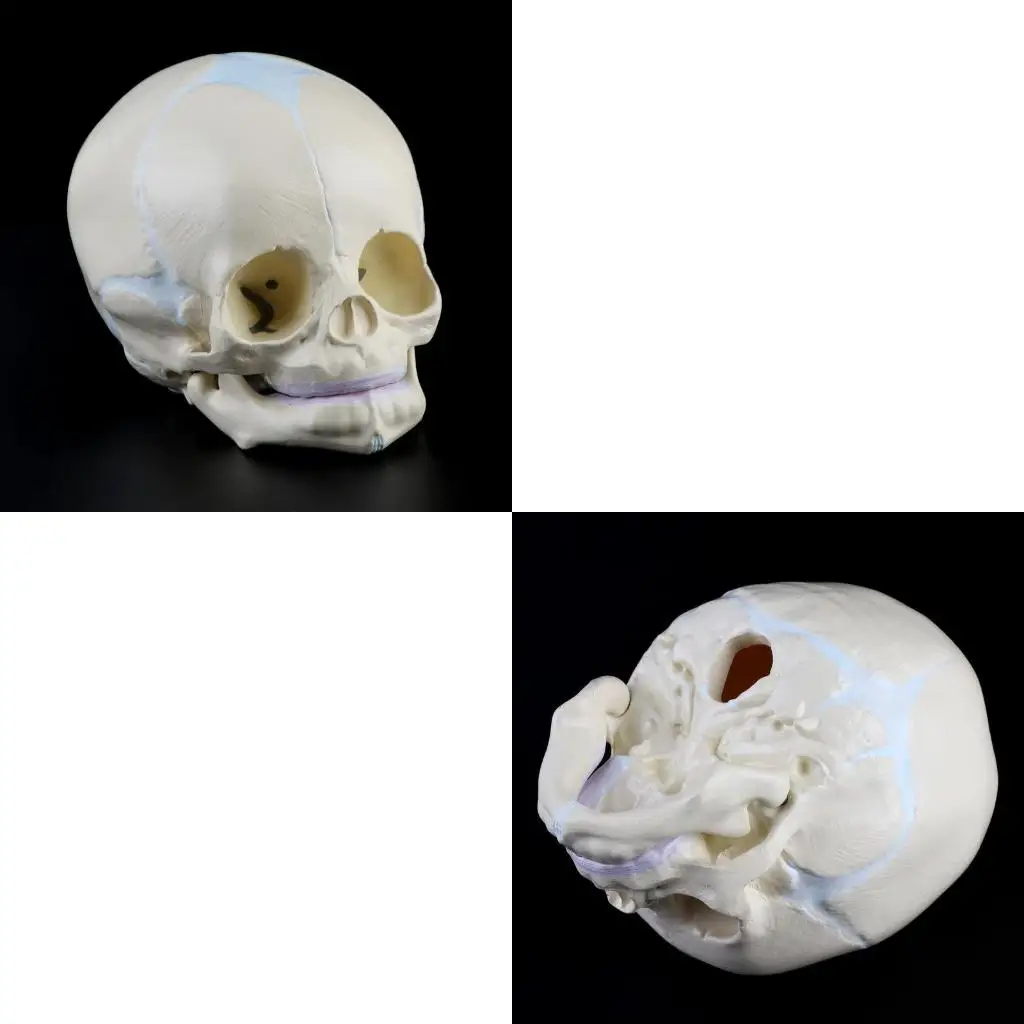  Anatomical Baby Head Skull Model Baby Skeleton Model Life Size Baby Head Bone Model with Moveable Lower Jaw