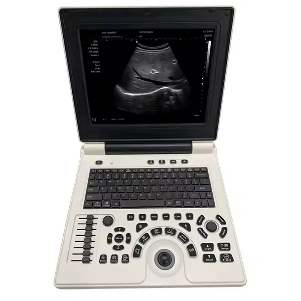 Harga Sistem Portabel Sonoscape E2pro Dijual Probe Human Being E2