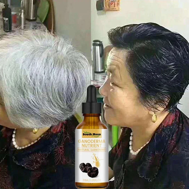 Gray White Hair Treatment Serum Liquid White To Black Natural Color Repair Nourish Scalp Anti Loss Hair Care Products Men Women