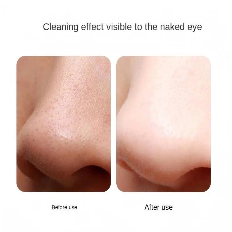 المهنية بالموجات فوق الصوتية العناية بالبشرة مقشر جهاز الوجه منظف المسام مصل ضخ مكافحة الشيخوخة المنزل الجمال أداة قناع الوجه