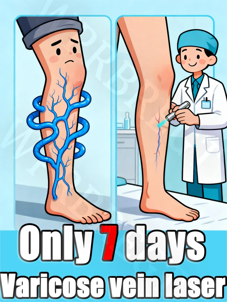 

2nd ɢᴇɴᴇʀᴀᴛɪᴏɴ ᴠᴀʀɪᴄᴏsᴇ vein instrument