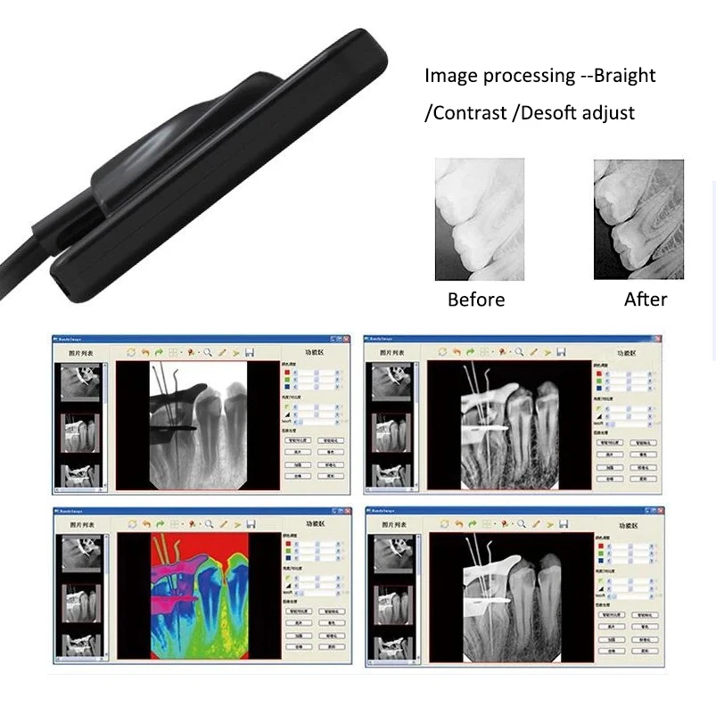 Dental X-Ray Sensor Intraoral Digital System HD lmaging Radiography Dentistry Equipment supply Portable Digital Sensor