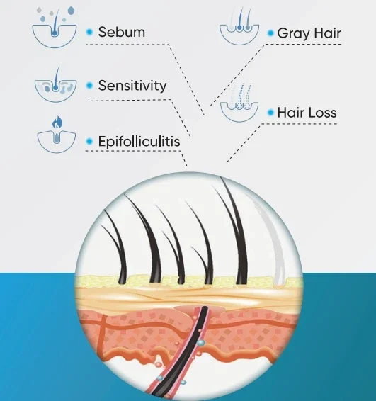 متوفر في المخزون MEICET M18S محلل فروة الرأس اللاسلكي الذكي الماسح الضوئي مجهر Dermascope الرقمي لفروة الرأس الجلدية