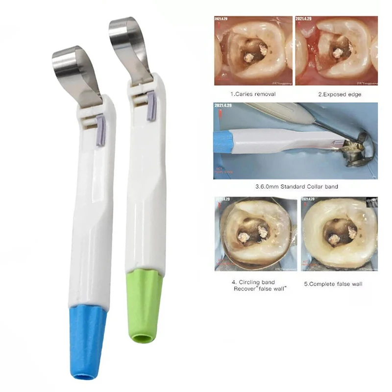 Banda de matriz Dental, anillo ajustable de matriz de acero inoxidable de 4,5/6mm, banda de matriz premetal Dental, anillo de matriz contorneada seccional